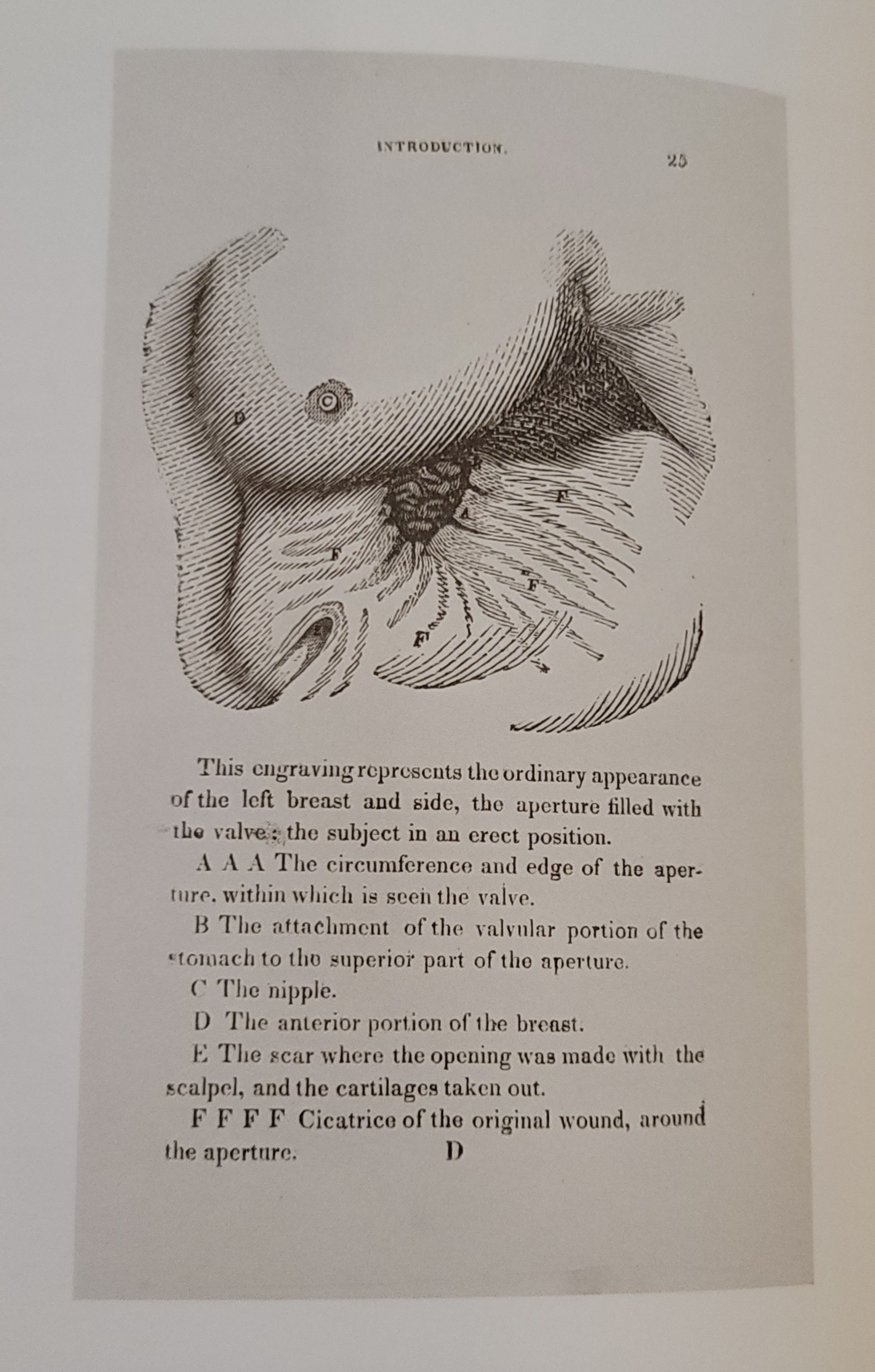 Experiments and Observations on the Gastric Juice, and the Physiology of Digestion | 1833 Experiments and Observations on the Gastric Juice, and the Physiology of Digestion