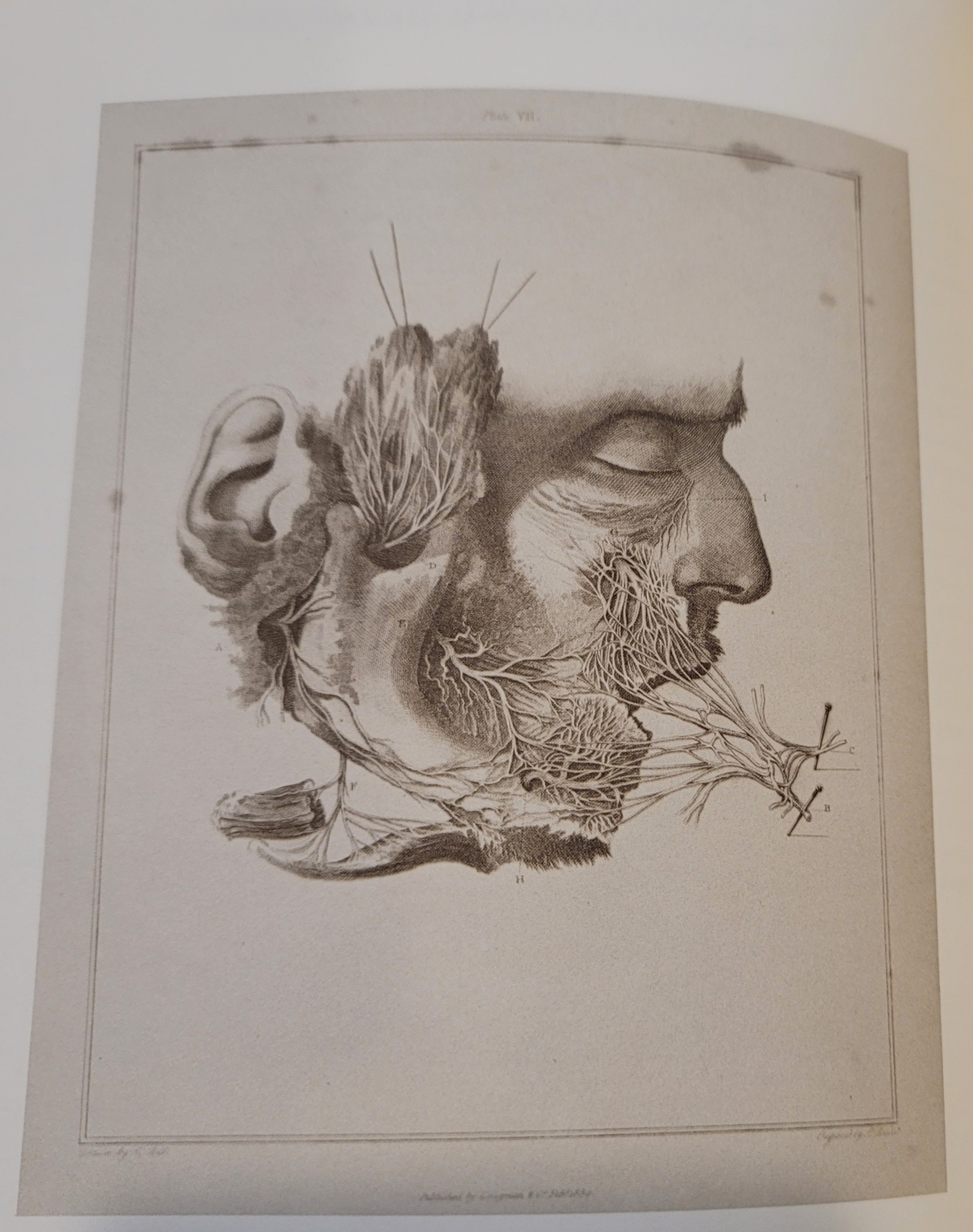 Idea of a New Anatomy of the Brain: submitted for the Observations of his Friends | 1811 Idea of a New Anatomy of the Brain: submitted for the Observations of his Friends
