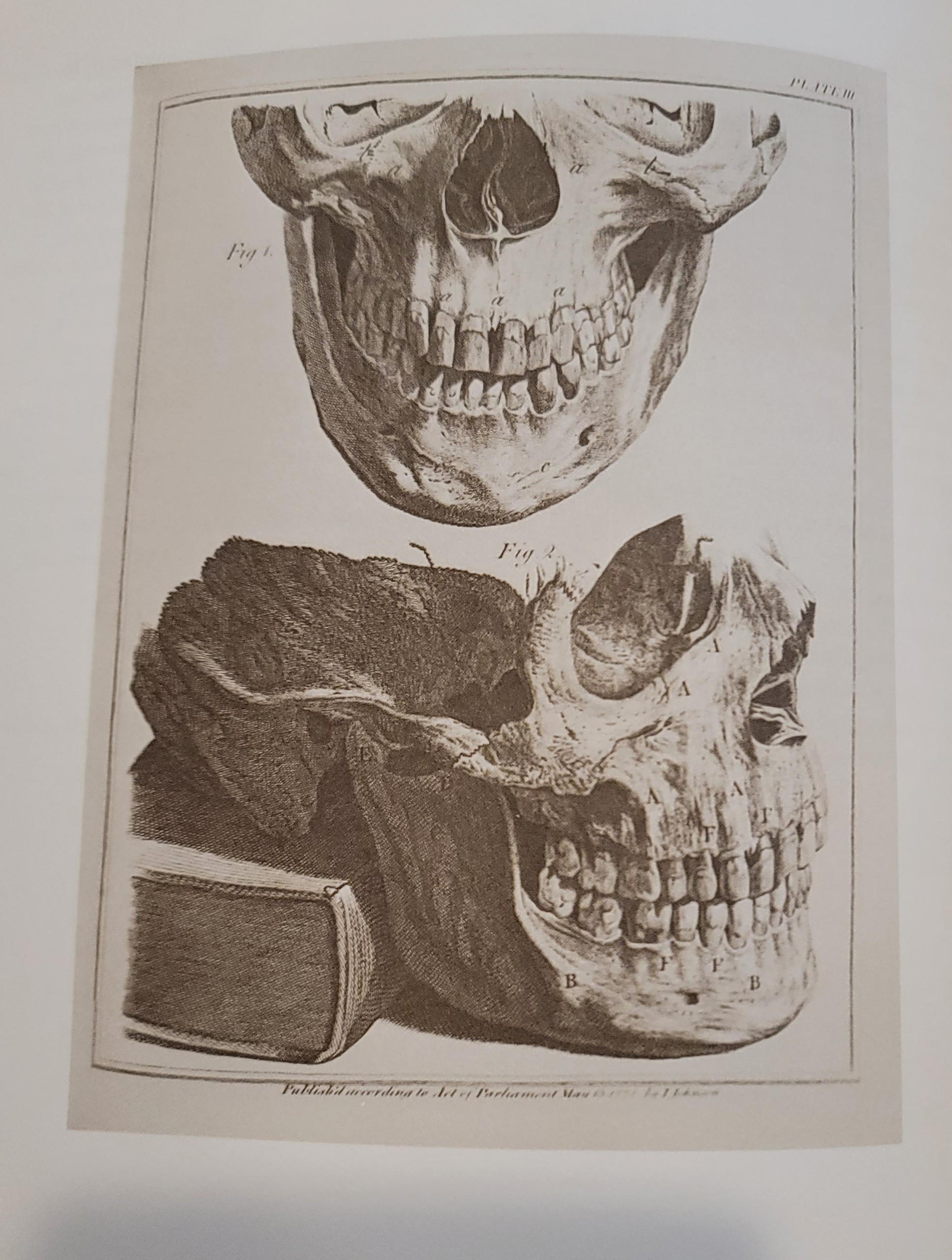 The Natural History of the Human Teeth | 1778 The Natural History of the Human Teeth