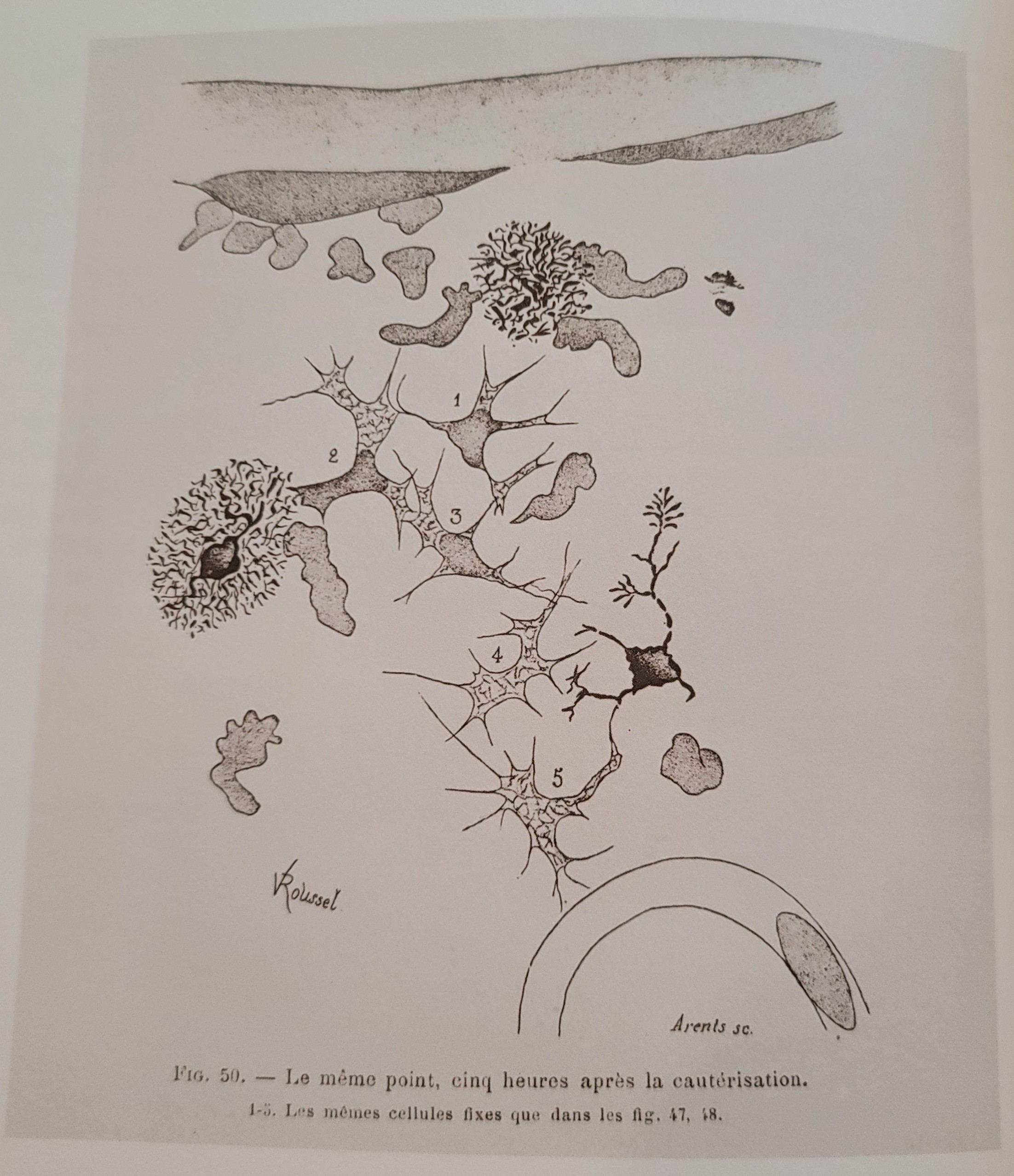 Leçons sur la pathologie comparée de l'inflammation, Faites à l'Institut Pasteur in 1891  | 1892 Leçons sur la pathologie comparée de l'inflammation, Faites à l'Institut Pasteur in 1891
