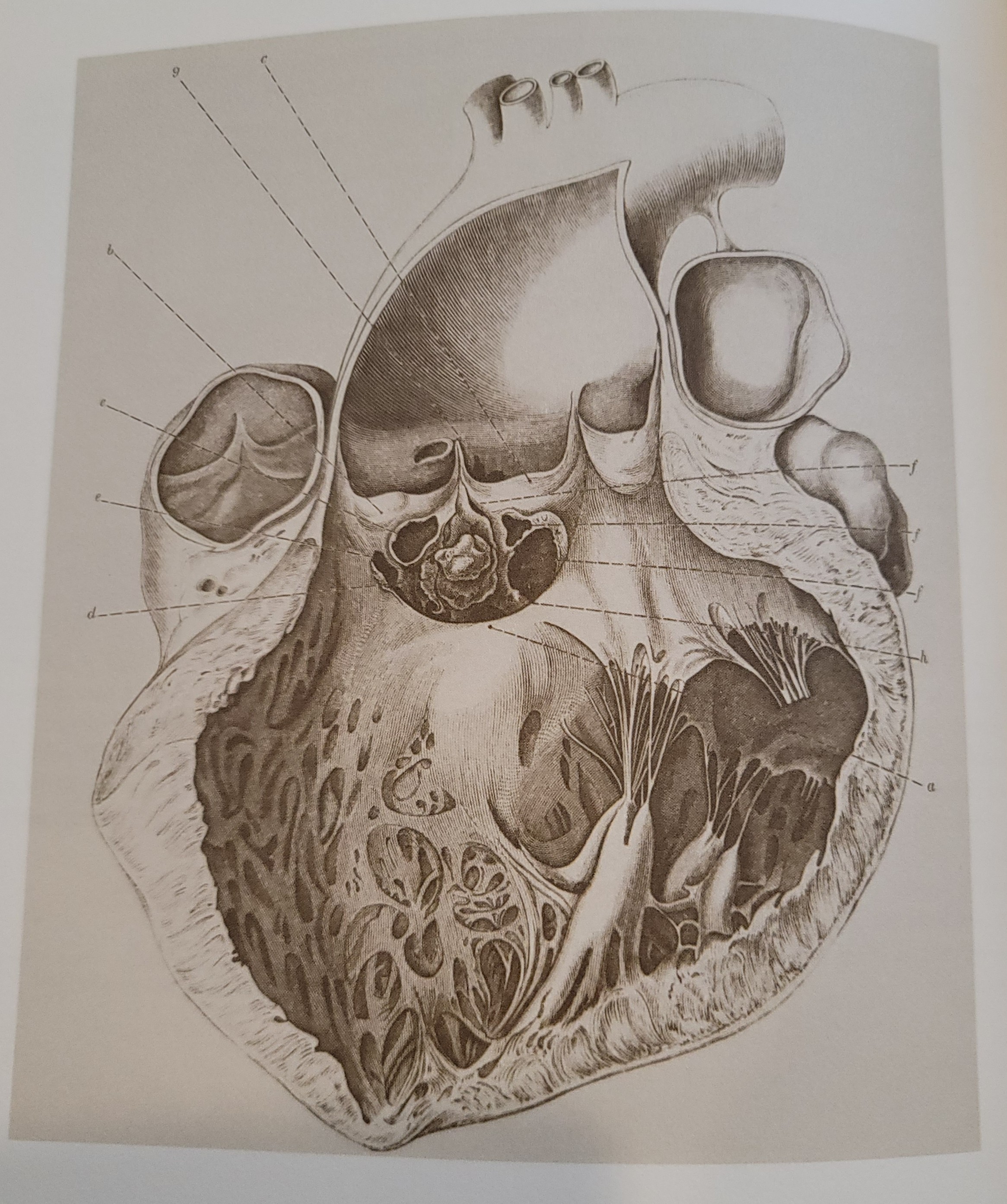 Handbuch der pathologischen Anatomie | 1842, 1844, 1846 Handbuch der pathologischen Anatomie