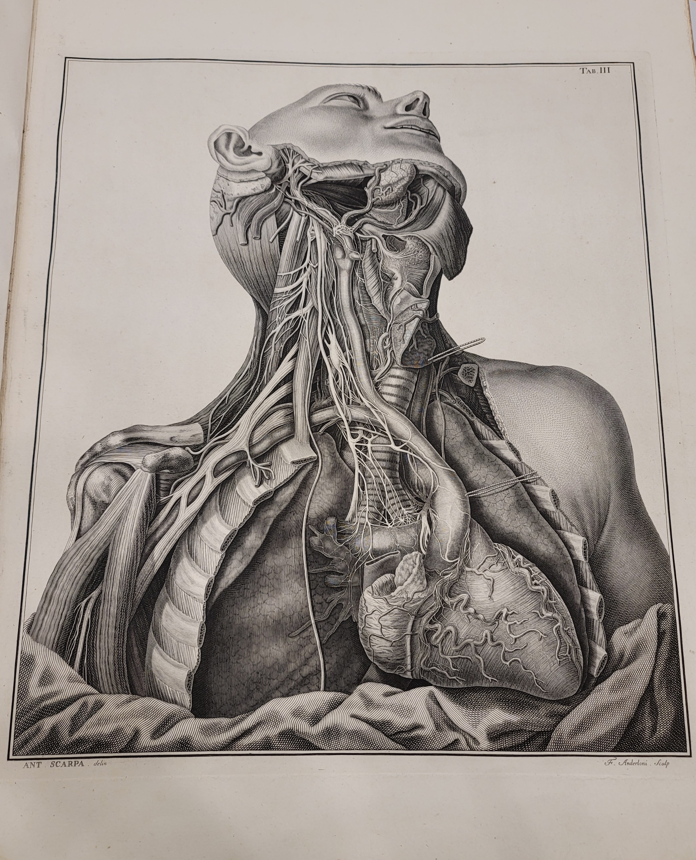 Tabulae Neurologicae ad illustrandam Historiam Anatomicam Cardiacorum Nervorum . . . | 1794 Tabulae Neurologicae ad illustrandam Historiam Anatomicam Cardiacorum Nervorum . . .